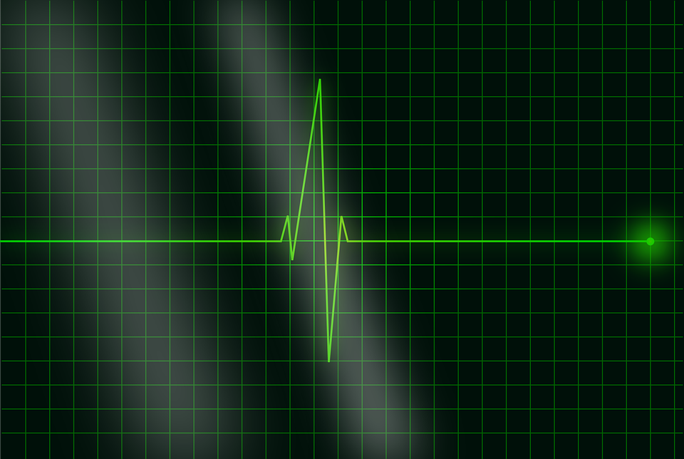 ECG Feature extraction and Classification